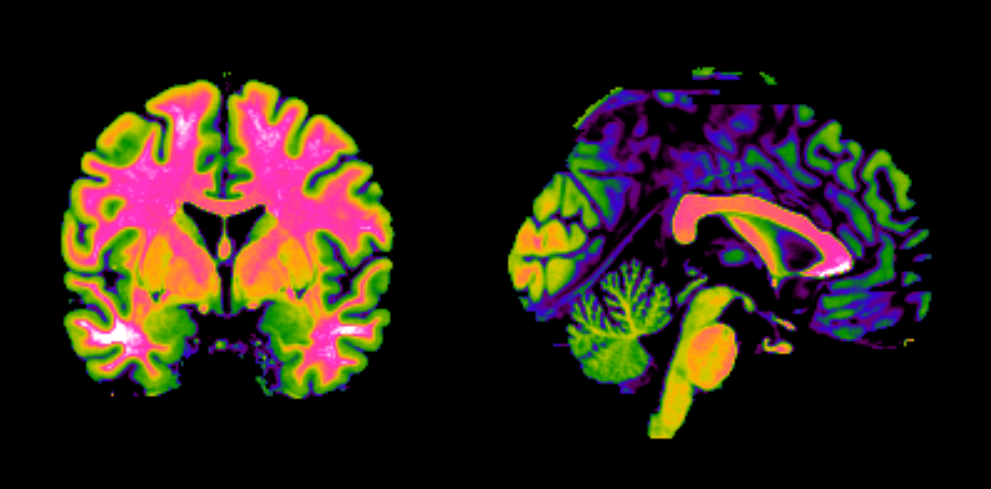 Cerveau Gret Neurosciences